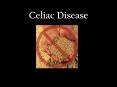 Celiac Disease PowerPoint PPT Presentation