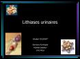 Lithiases urinaires PowerPoint PPT Presentation