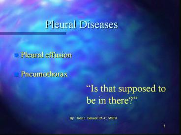 Pleural Diseases