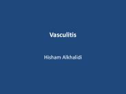 Vasculitis