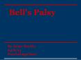 Bell's%20Palsy PowerPoint PPT Presentation