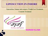 Liposuction In Indore