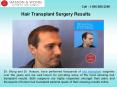 Hair Transplant Surgery in British Columbia PowerPoint PPT Presentation