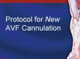 Protocol for New AVF Cannulation PowerPoint PPT Presentation