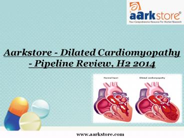 Aarkstore - Dilated Cardiomyopathy - Pipeline Review, H2 2014