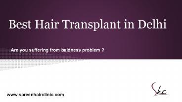 Hair Transplant in Delhi