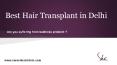 Hair Transplant in Delhi PowerPoint PPT Presentation