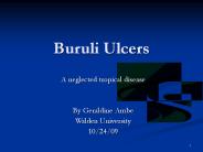 Buruli Ulcers