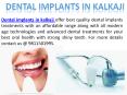Delhi Top Dental Implants Clinic in kalkaji & East of Kailash PowerPoint PPT Presentation