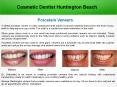 Cosmetic Dentist Huntington Beach PowerPoint PPT Presentation