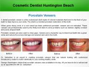 Cosmetic Dentist Huntington Beach