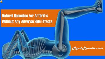 Natural Remedies For Arthritis Without Any Adverse Side Effects