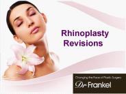 Need of Cosmetic Surgery  In Today’s Environment