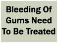 Bleeding Of Gums Need To Be Treated PowerPoint PPT Presentation