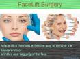 Facelift surgeon PowerPoint PPT Presentation