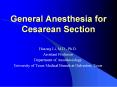 General Anesthesia for Cesarean Section PowerPoint PPT Presentation