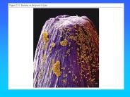 Prokaryote and Metabolism