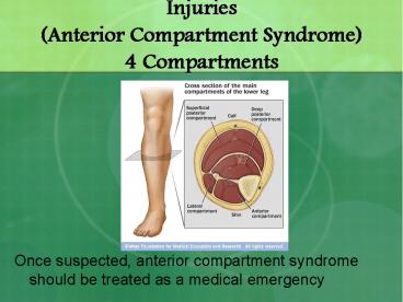 Injuries (Anterior Compartment Syndrome) 4 Compartments