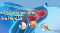 Natural Bone And Joint Support Supplements Review By Ayurveda Expert PowerPoint PPT Presentation