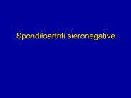 Spondiloartriti sieronegative