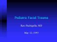 Pediatric Facial Trauma PowerPoint PPT Presentation