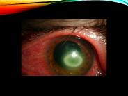 Nerve activates contraction