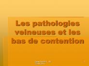 Les pathologies veineuses et les bas de contention