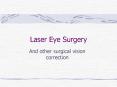 Laser Eye Surgery PowerPoint PPT Presentation