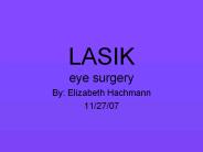 LASIK%20eye%20surgery