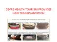 CEVRE HEALTH TOURISM PROVIDES HAIR TRANSPLANTATION PowerPoint PPT Presentation