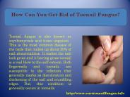 How Can You Get Rid of Toenail Fungus? (1)