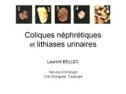 Coliques n