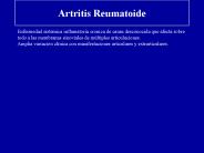 Artritis Reumatoide