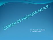 CANCER DE PR