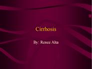 Cirrhosis