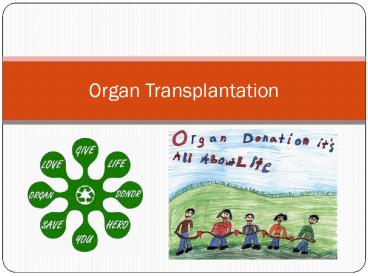 Organ%20Transplantation