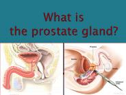 What is the prostate gland?