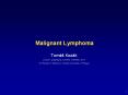 Malignant Lymphoma PowerPoint PPT Presentation