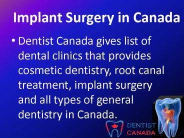 Implant Surgery in Canada