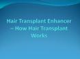Hair Transplant Enhancer - How Hair Transplant Works PowerPoint PPT Presentation