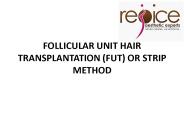 Hair transplant in Bangalore