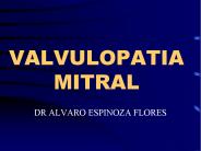VALVULOPATIA MITRAL