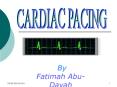 CARDIAC PACING PowerPoint PPT Presentation