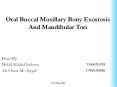 Oral Buccal Maxillary Bony Exostosis And Mandibular Tori PowerPoint PPT Presentation