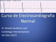 Curso de Electrocardiograf