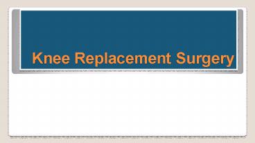 Knee Replacement Surgery in Delhi