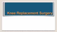 Knee Replacement Surgery in Delhi