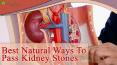 Best Natural Ways To Pass Kidney Stones Safely PowerPoint PPT Presentation