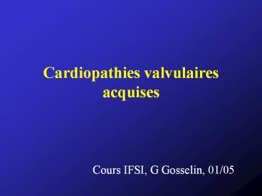 Cardiopathies valvulaires acquises