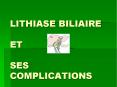 LITHIASE BILIAIRE  ET  SES COMPLICATIONS PowerPoint PPT Presentation